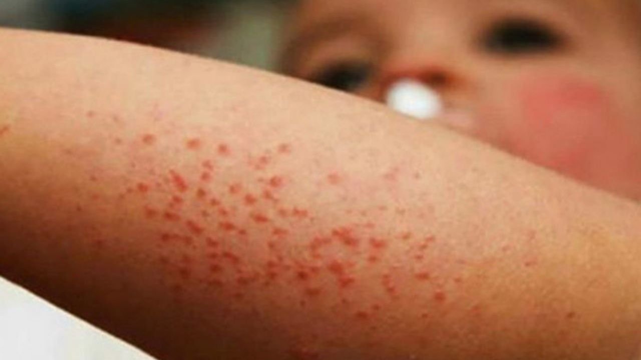 dos-ninos-menonitas-mueren-por-sarampion-en-chihuahua-salud-urge-a-vacunar-a-menores.jpg